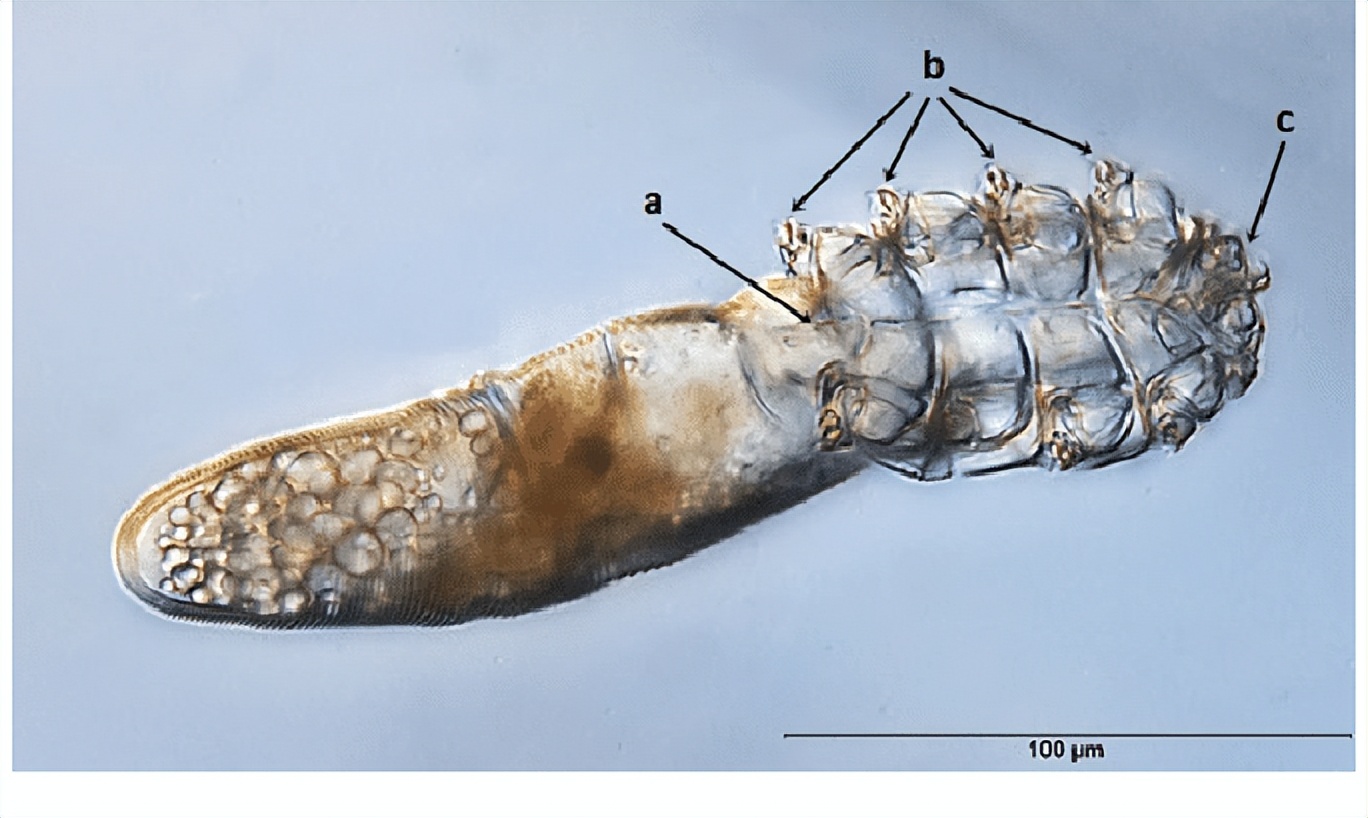 寄生螨正在逐渐学会和我们和平相处