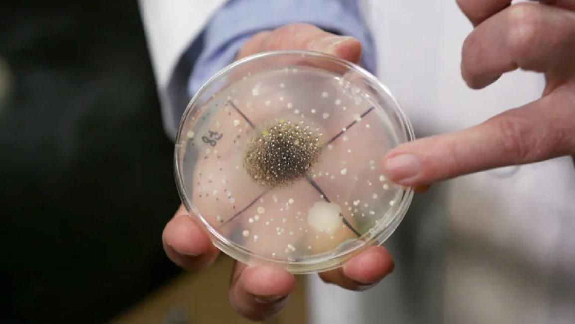 比如对容易滋生细菌的地方涂上化合物,二氧化钛通常会作为一种表面