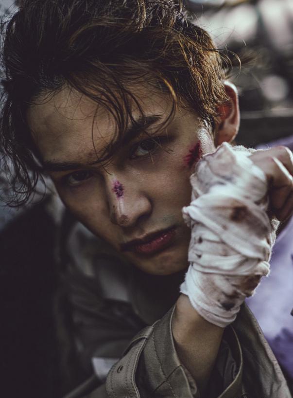 原创同样是明星受伤妆成毅让人心疼杨洋英气看到鞠婧祎太假了