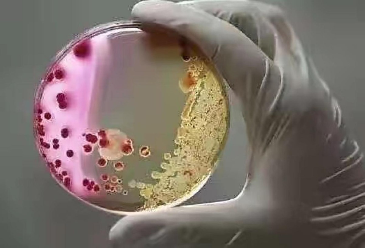 食肉菌潜伏期图片
