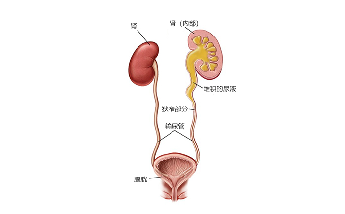 双j管的作用图片