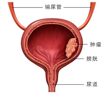 膀胱位置示意图图片