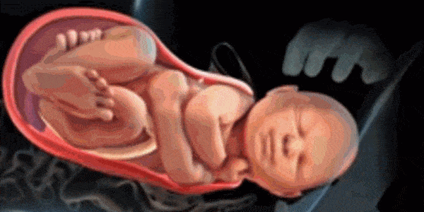 生产时胎儿＂被拽出来＂是什么感觉？如何避免顺产生娃胎儿＂被拽出来＂