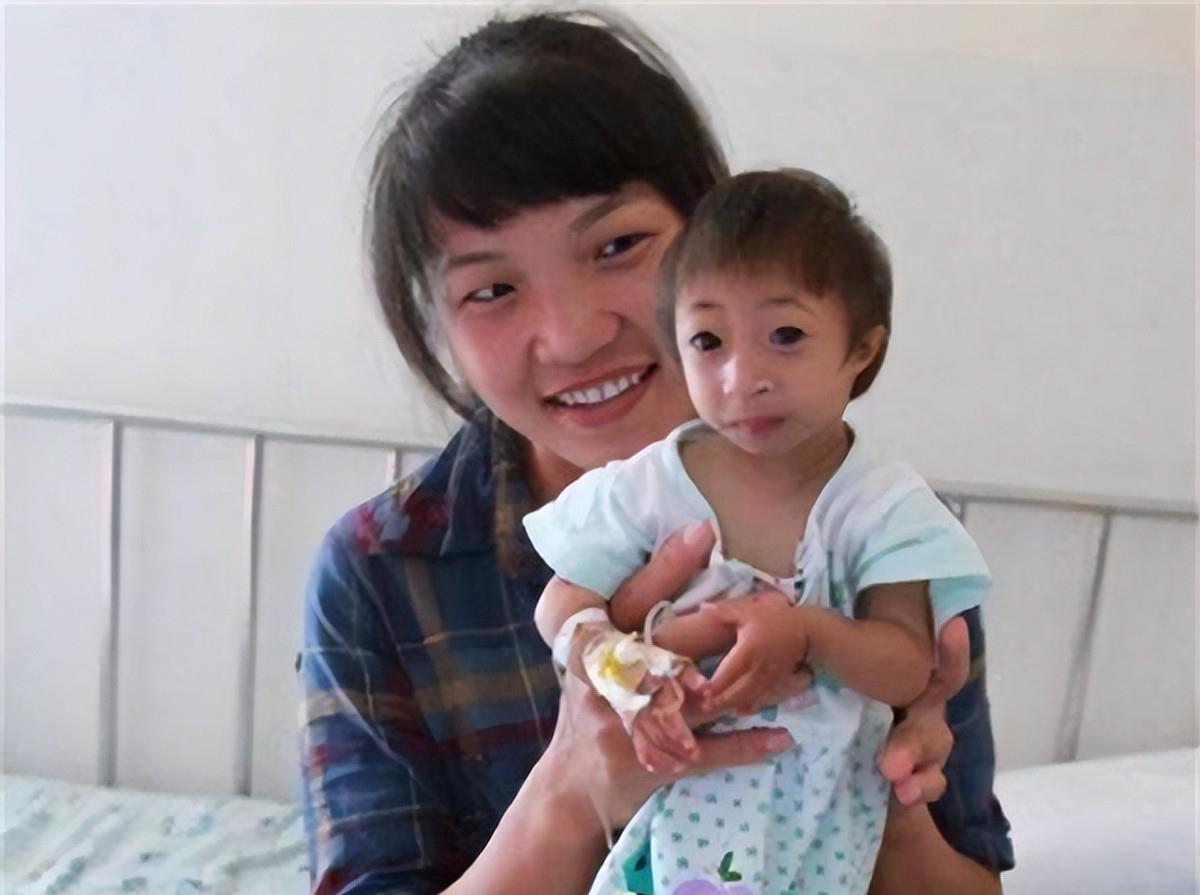 2009年,湖南女子生下重2斤"小猴子"_刘兴莲_孩子_医生