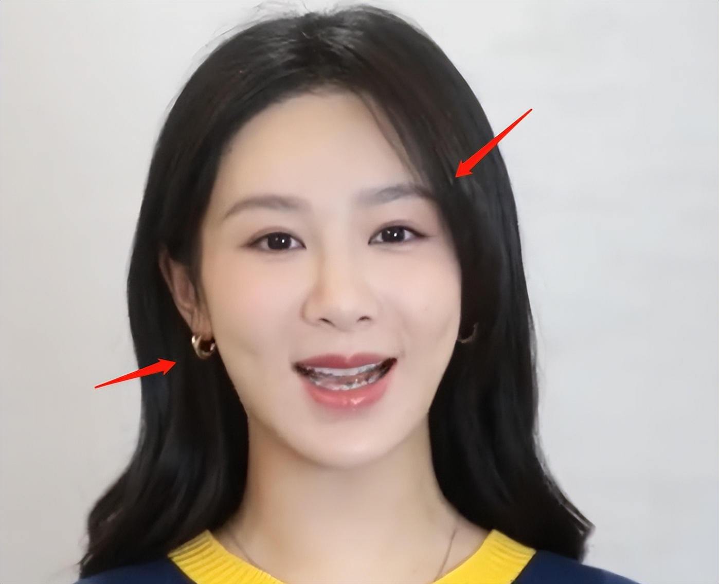 杨紫最新露面脸部肿胀,颧骨高凸苹果肌抢镜,网友直呼像蔡明_造型_视频