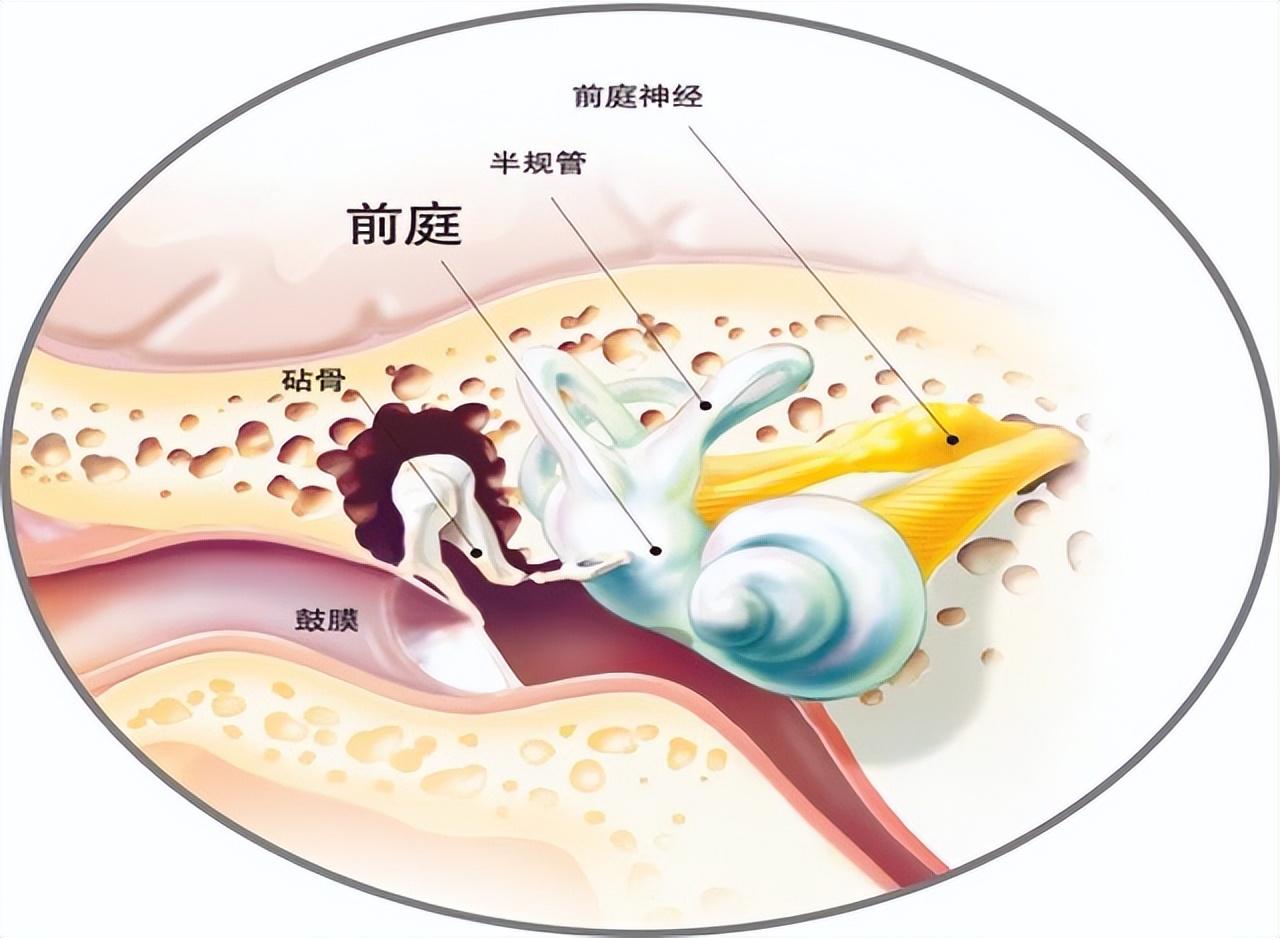 畸形,属常染色体隐性遗传性疾病,是导致儿童感音神经性耳聋的常见原因