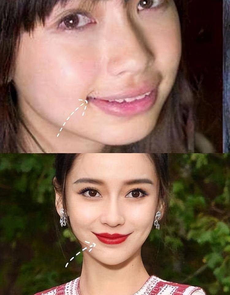 这些凸嘴的明星,确实会削弱美感_问题_情况_嘴唇
