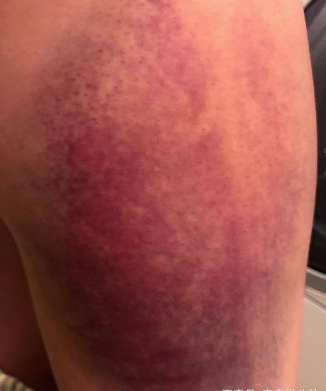 蒋劲夫承认家暴日本女友,女方多处淤青并指控他家暴后行踪不明_微博