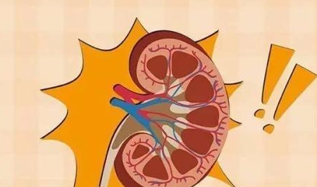 多囊肾患者能活多长时间?_病情_什么_治疗