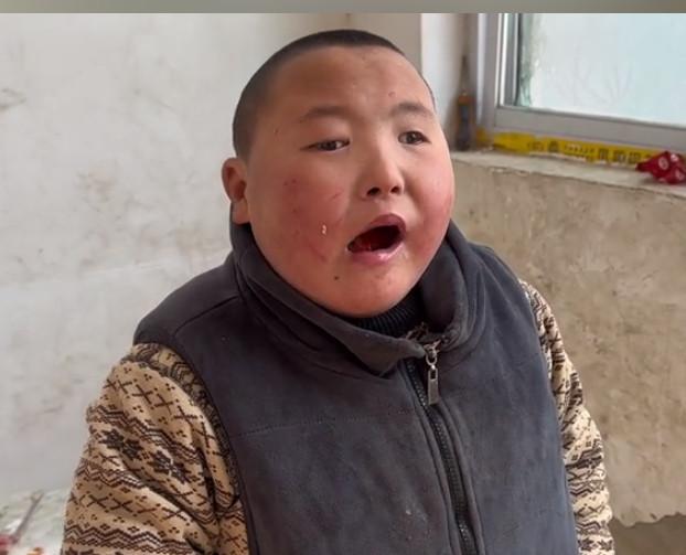 农村小杨为父母错误买单,24岁照顾4个残疾,被网友质疑是剧本_生活