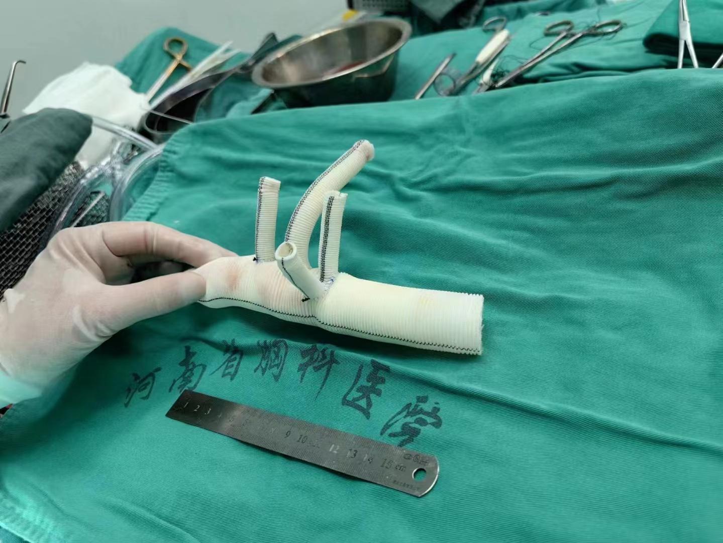 河南首例"巨创手术"成功实施,患者恢复良好_主动脉_夹层_心血管