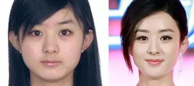 赵丽颖由丑变美:瑜伽习练可以有"换脸"效果!