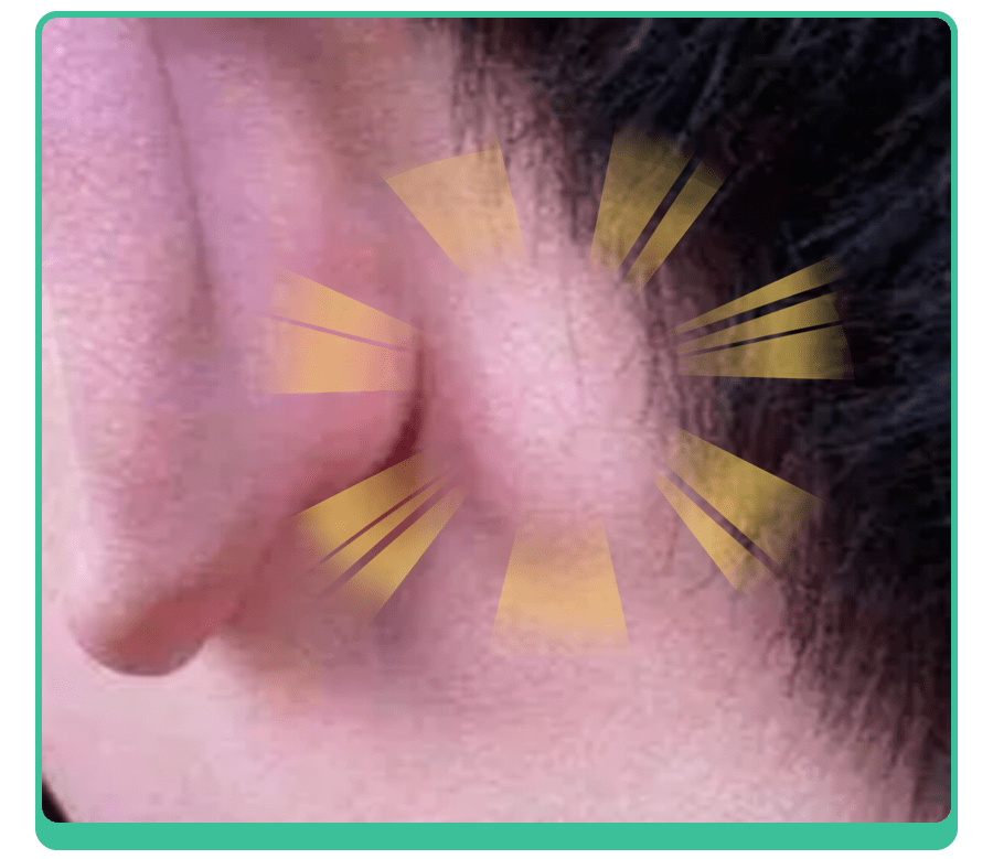耳后长鼓包是导致孩子鼻窦炎,听力下降的元凶吗？