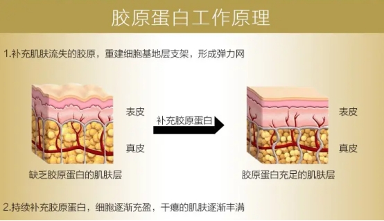 水解胶原蛋白是什么成分，什么牌子的水解胶原蛋白好？