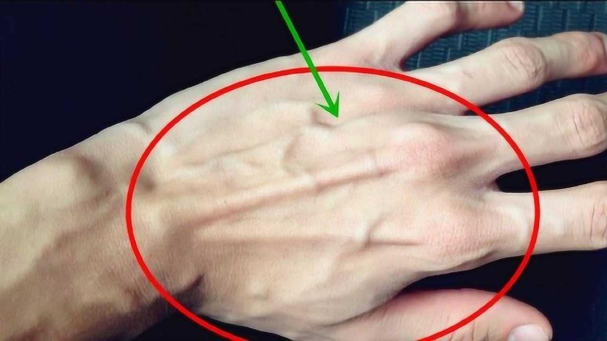 为何有些人手臂"青筋暴起",有人却看不到"青筋",看完明白了_静脉_血管