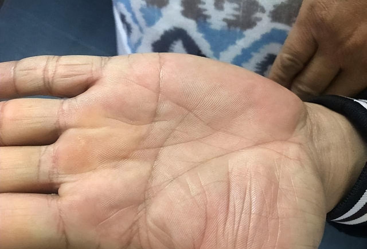 俗语:"三角纹在手,富到九十九",三角纹到底在哪?准不准呢?