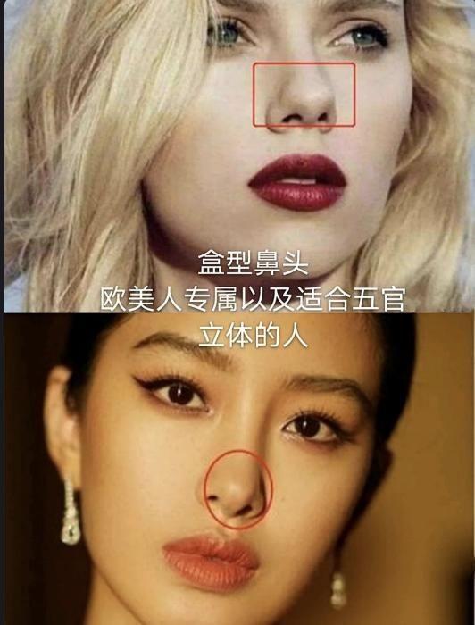 2023年流行的鼻头,居然是盒型鼻_皮肤_球形_鼻尖