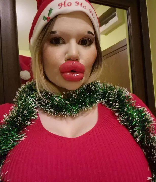 女子痴迷丰唇成为全球嘴唇最厚网红,拍卖自己的厚唇热吻_安德里亚_全