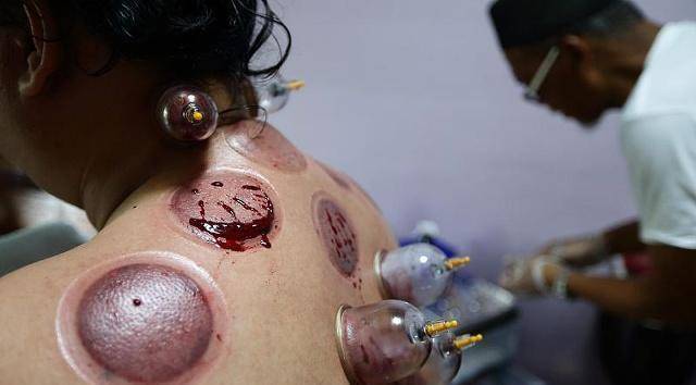 如果在身体疲劳或者是体内有湿气的情况下,如果坚持拔罐的话能够让你