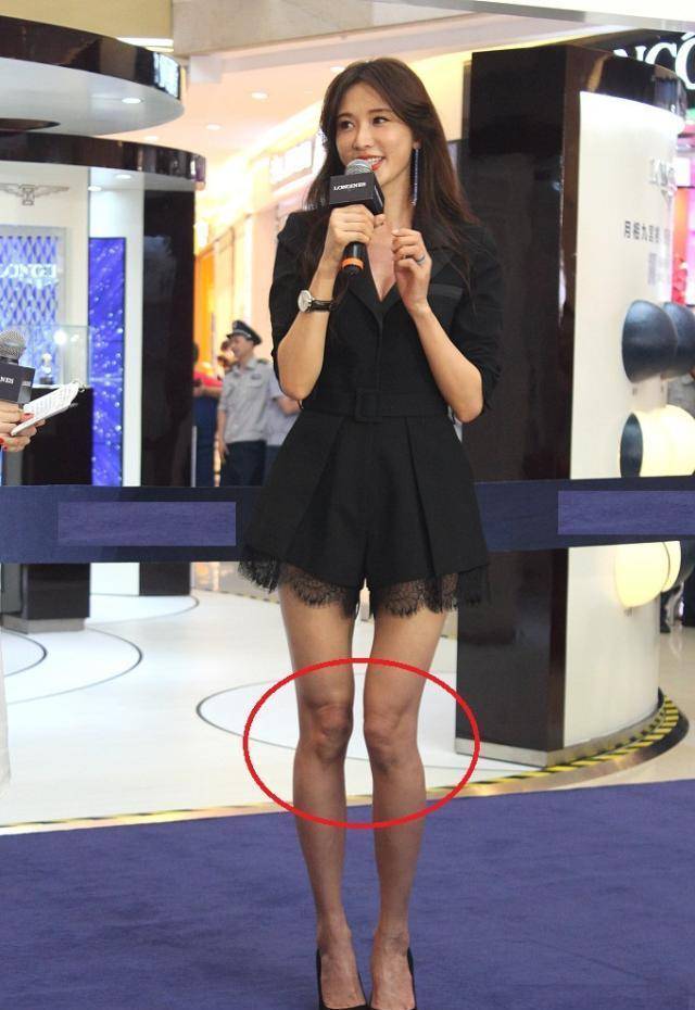 "褶皱"多肤色黑,x型腿看着有点怪_照片_活动_双腿