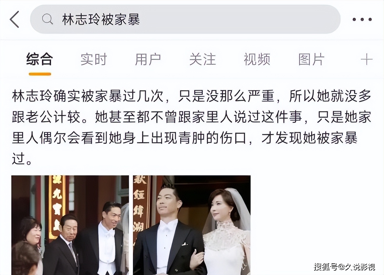 林志玲被家暴打出假体,粉丝却不心疼,多数认为这是必然结果!