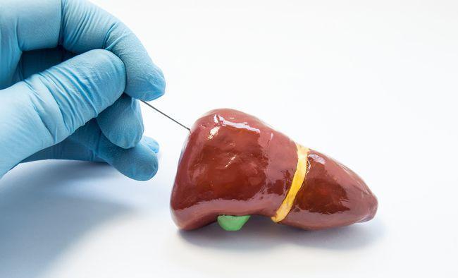 2019年的慢性乙肝防治指南提出,治疗小三阳肝炎的目标是最大程度的