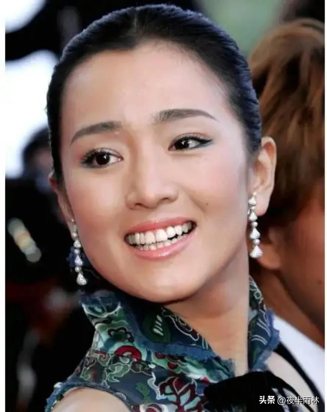 超级女子都有美人痣?