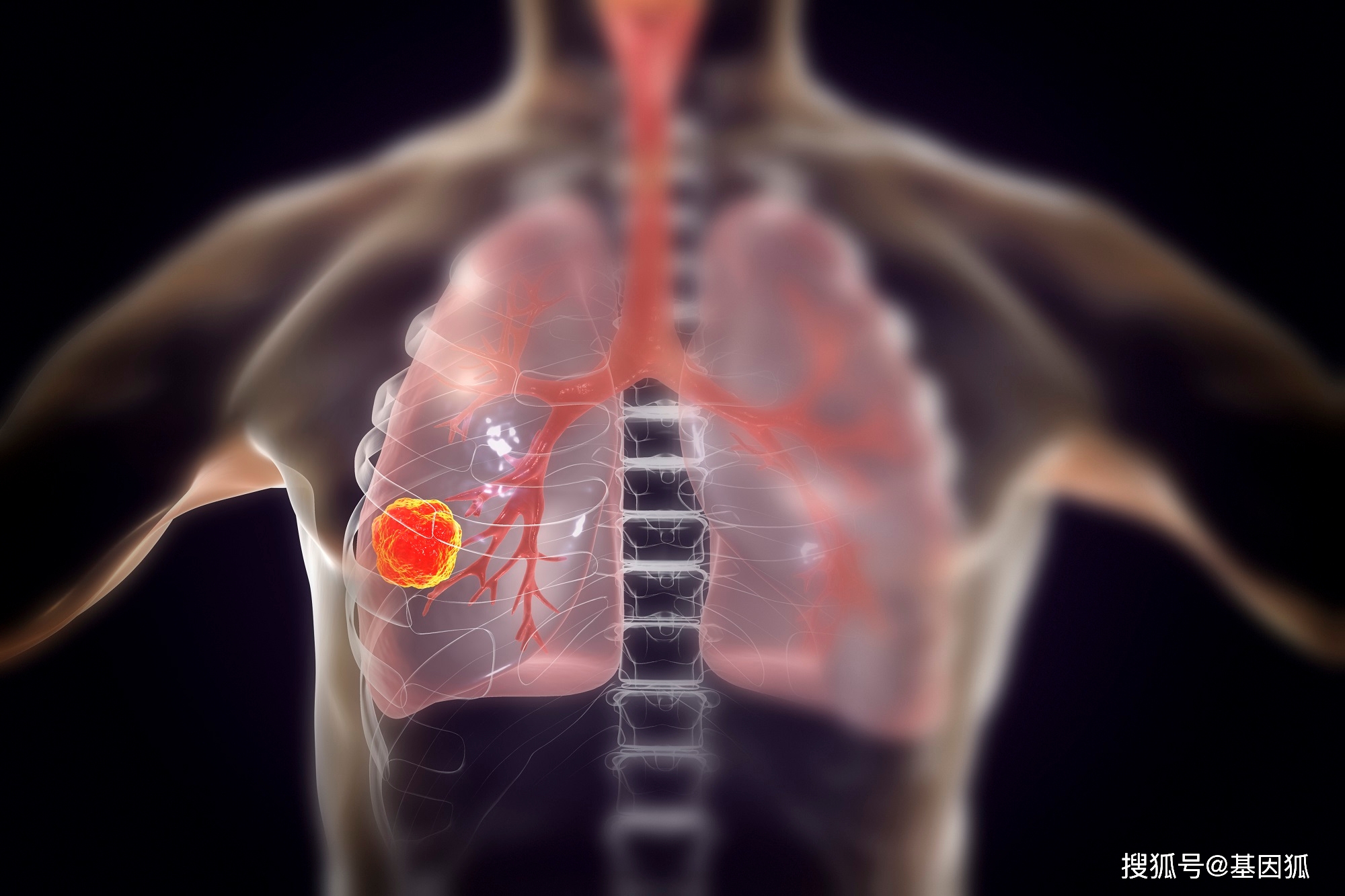 身体出现四种症状提示肺癌，坚持吃两种食物，能离肺癌更远！