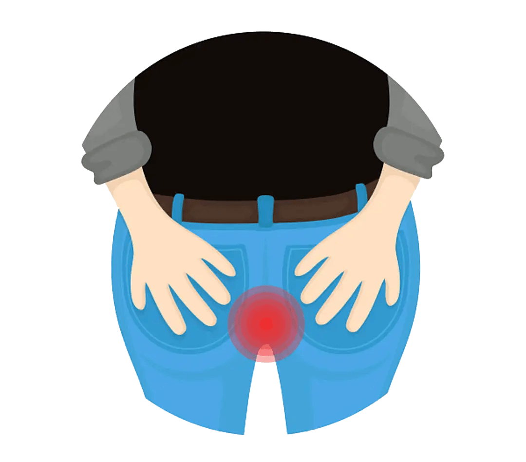 菊花痒到坐立难安?可能是肛毛太多惹的祸_疾病_肛门_皮肤