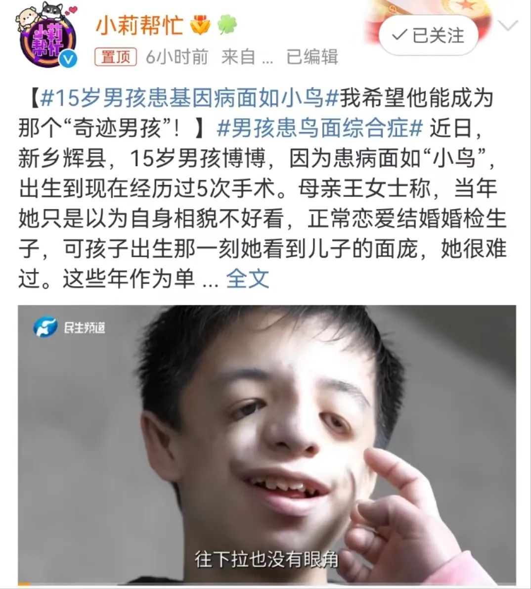不好看,正常恋爱结婚,婚检生子,不知怎么生出博博如此"奇怪"的面容