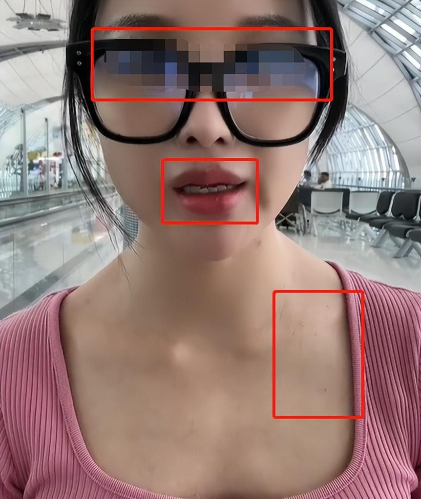 多位女网红泰国失联,脖子布满针孔眼神涣散,疑似被威胁拍下视频_网友