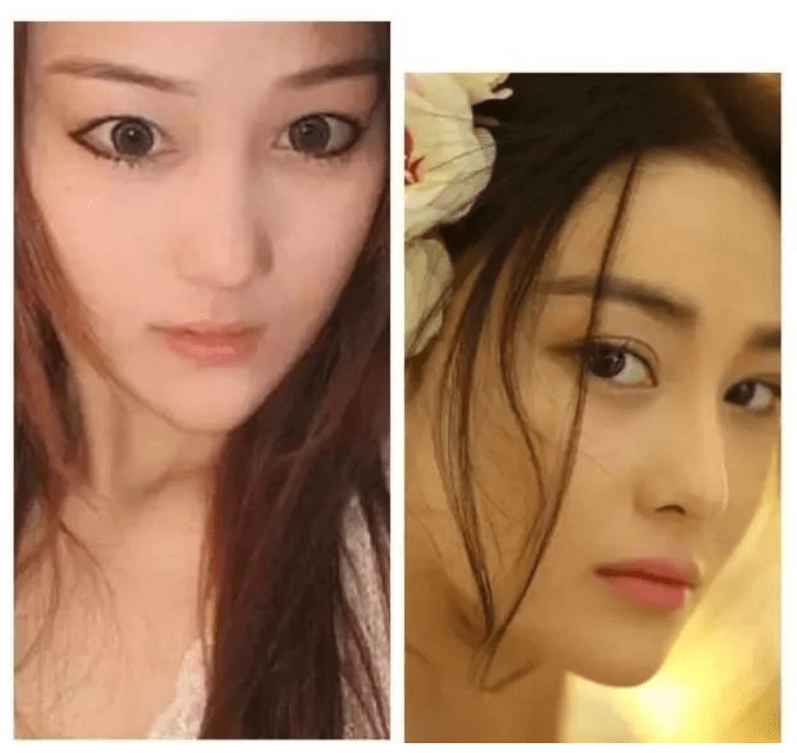 张馨予近照大变样,被质疑整容割了双眼皮,本人发声否认没微调_状态