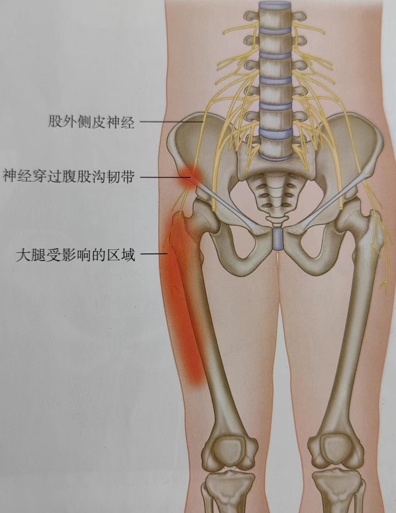 股外侧皮神经从腰2,腰3发出,进入骨盆的前外侧方,被髂窝和腹股沟韧带