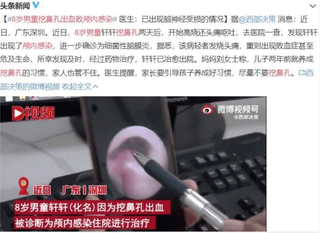 小孩老是喜欢抠鼻孔是什么原因 家长如何纠正？