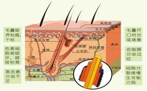 脱发必知丨如何正确认识毛囊单位?