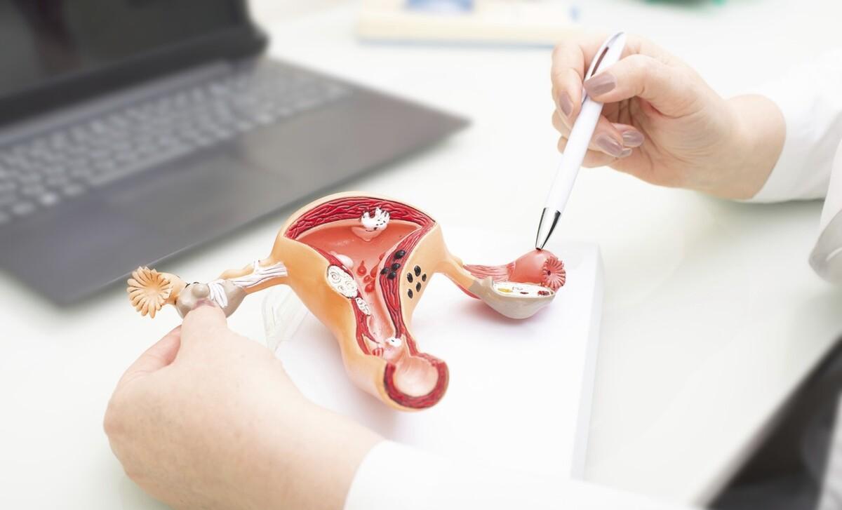 下身有这几种变化,警惕阴道肥大,危害不要难以启齿_张娟_肌肉_女性