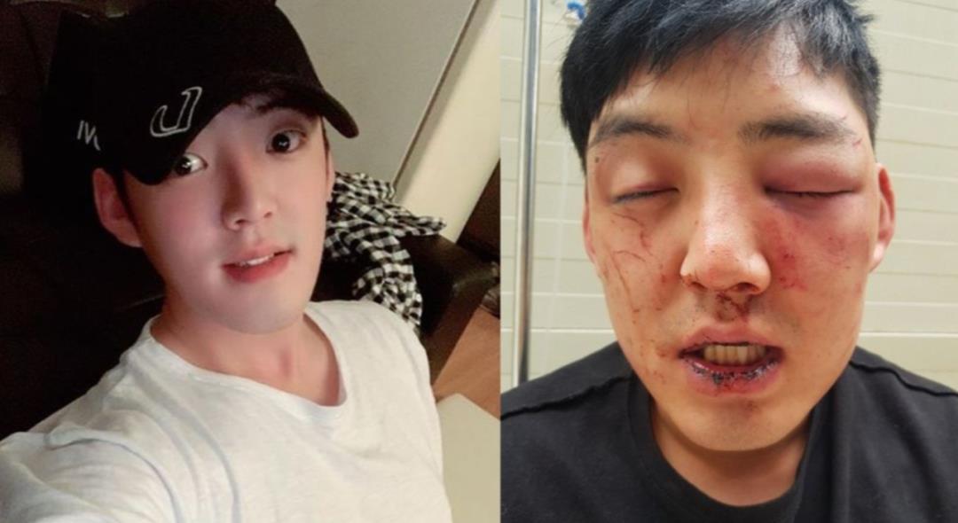 肌肉男网红被抓了,打残帅哥弟弟侵犯员工?他到底图什么?