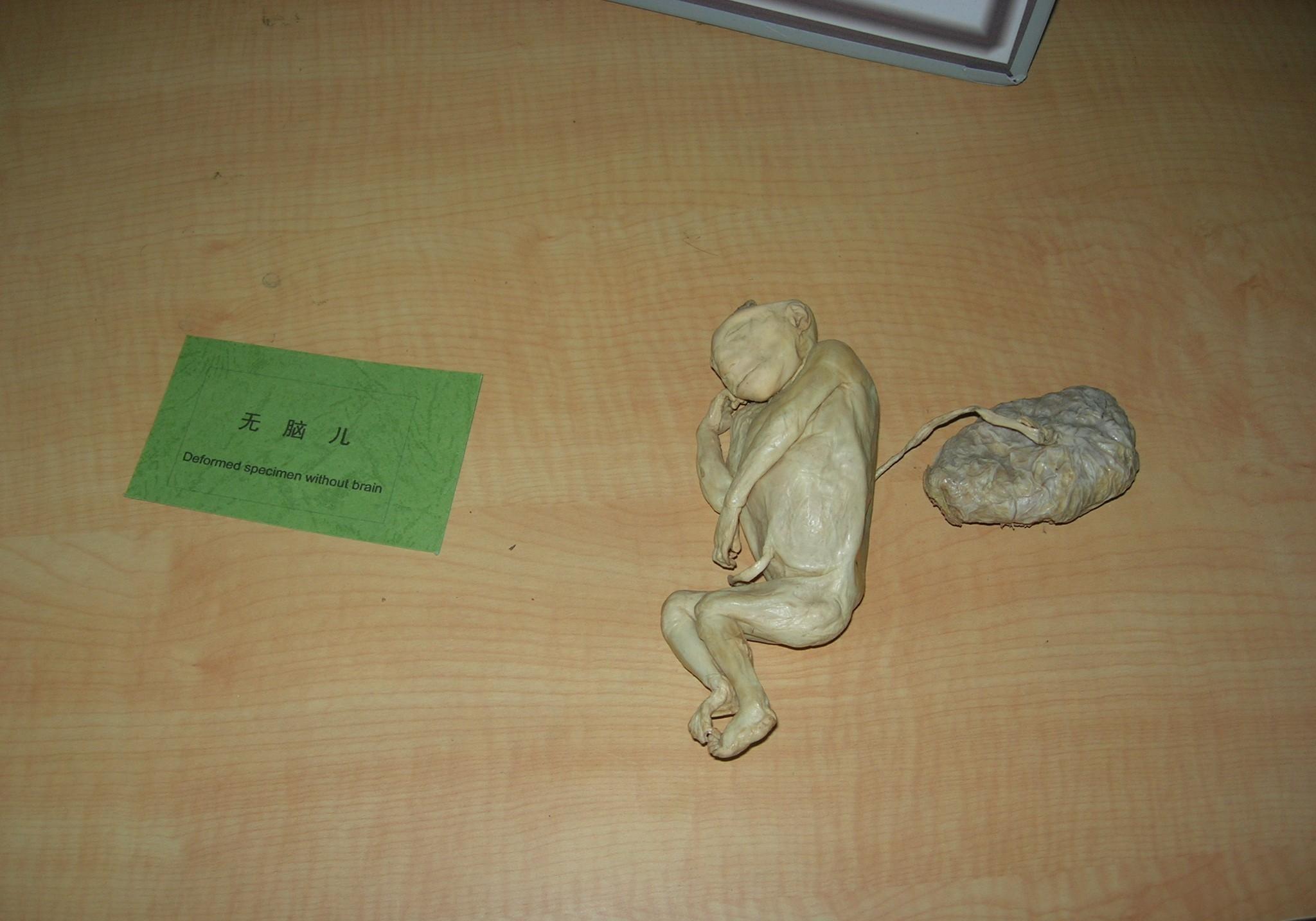 婴儿标本解剖图片