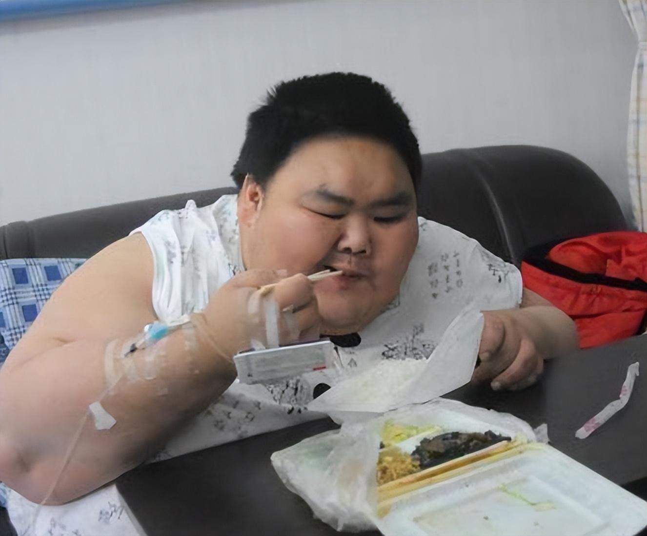 "山东第一胖"王浩楠现状堪忧,切胃后遗症难消,网友:还得手术