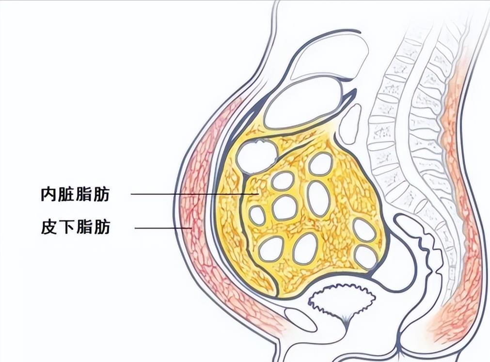 皮下脂肪和内脏脂肪的区别在哪里?了解清楚后减肥不再是难事!