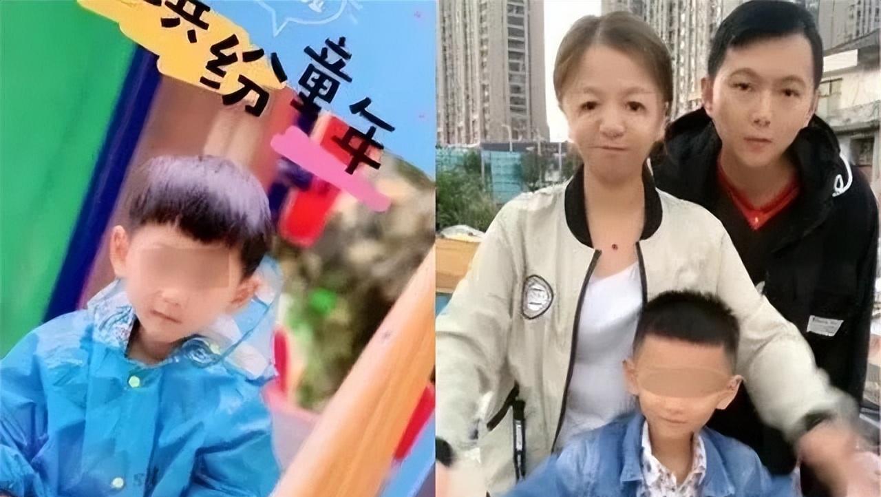 鸟面综合症婴儿图片图片