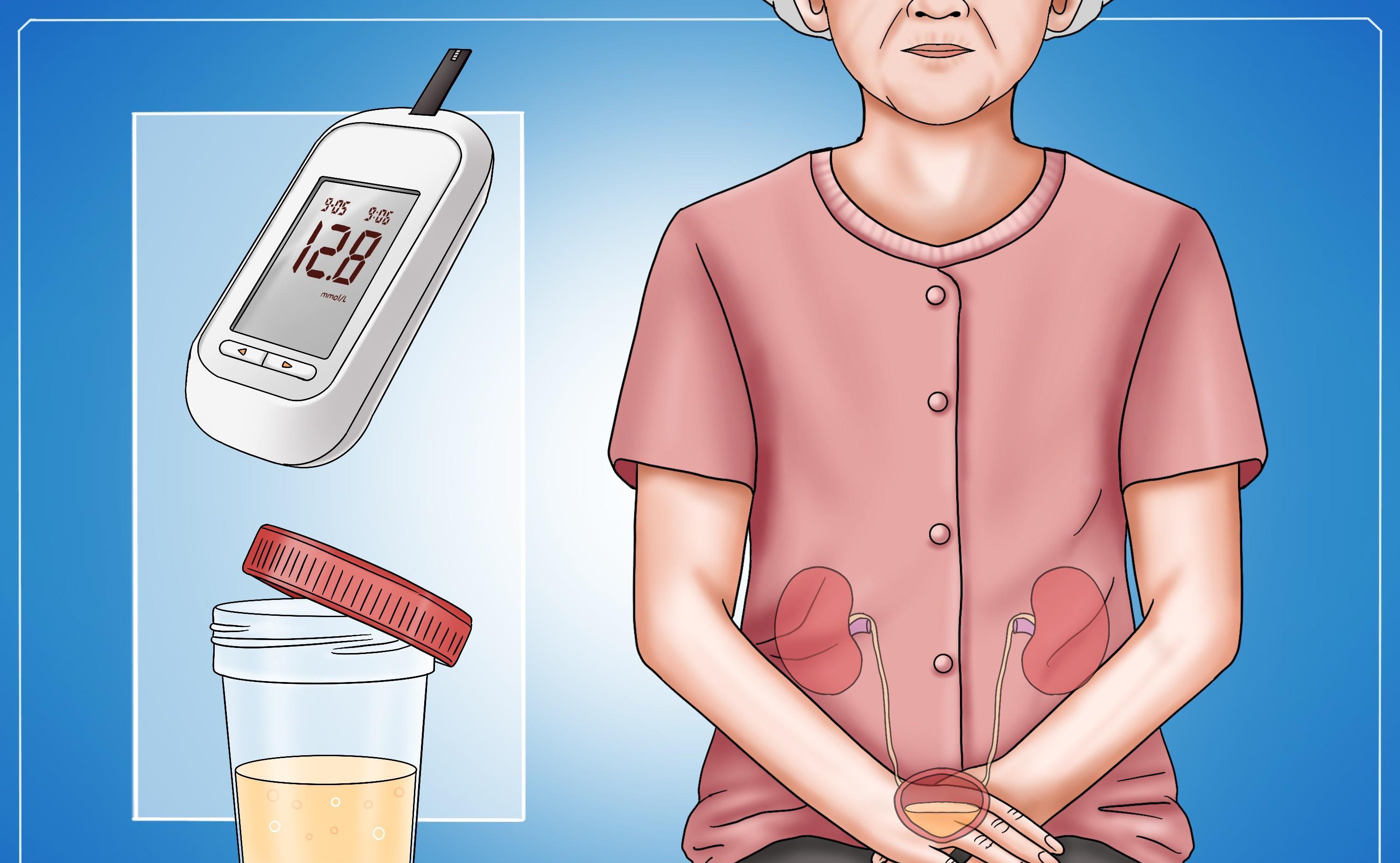 降低尿蛋白,拯救肾脏:治疗糖尿病肾病的3类药物_患者_作用_沙坦