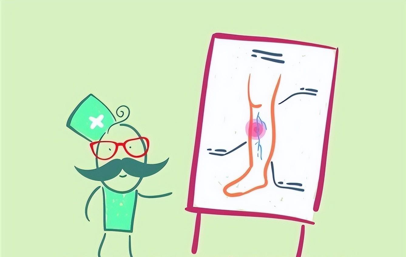 放假期间,久坐不动,应该多做踝泵运动,预防血栓形成_下肢_血管_风险