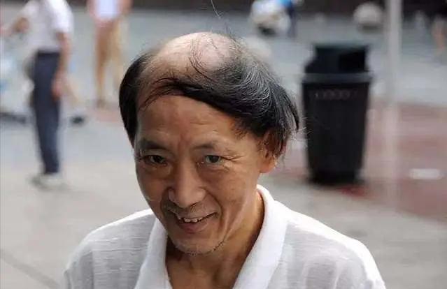 女老师植发视频(植发的视频全过程)