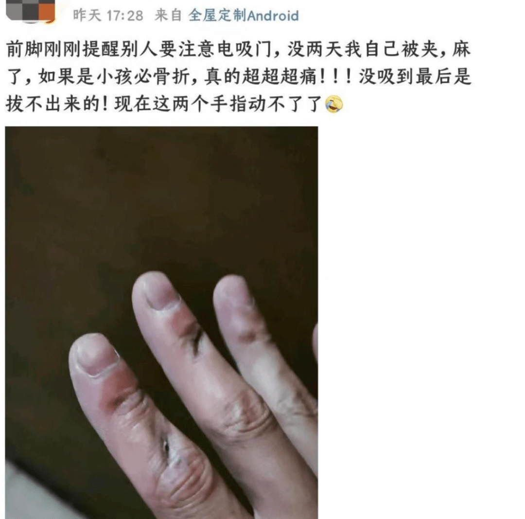 严重可夹断手指,电吸门安全隐患,这个原因导致不能增加防夹功能_搜狐汽车_搜狐网