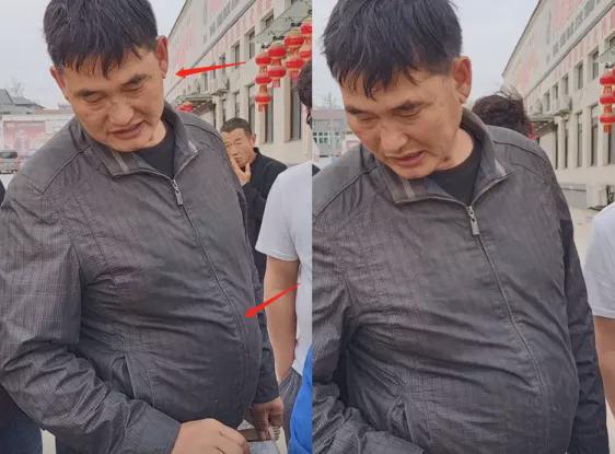 肚子耳朵暴露被劝快就医?称遭某公司威胁_演出_朱之文_耳垂