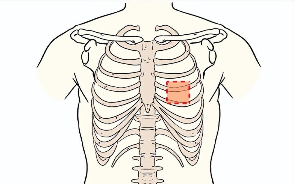 左肋疼痛位置图图片图片