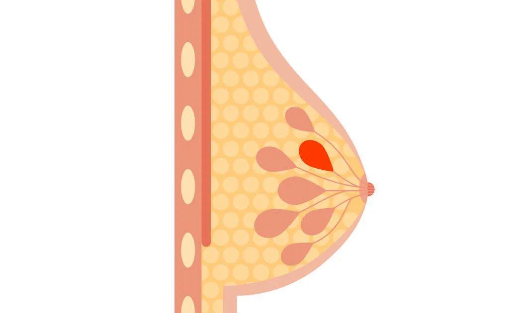 报告里这个数字越小越安全!_可能性_情况_乳房