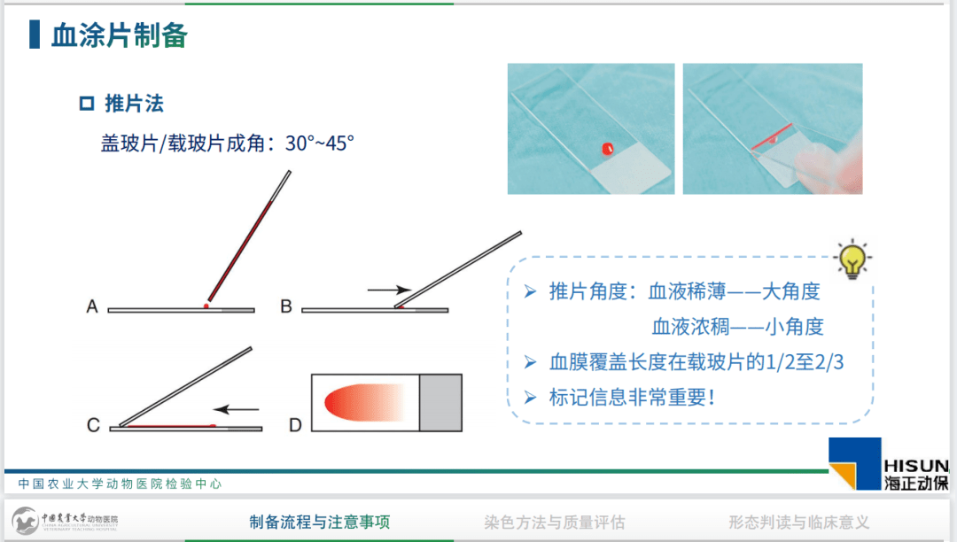 那么采用推片法制备血涂片