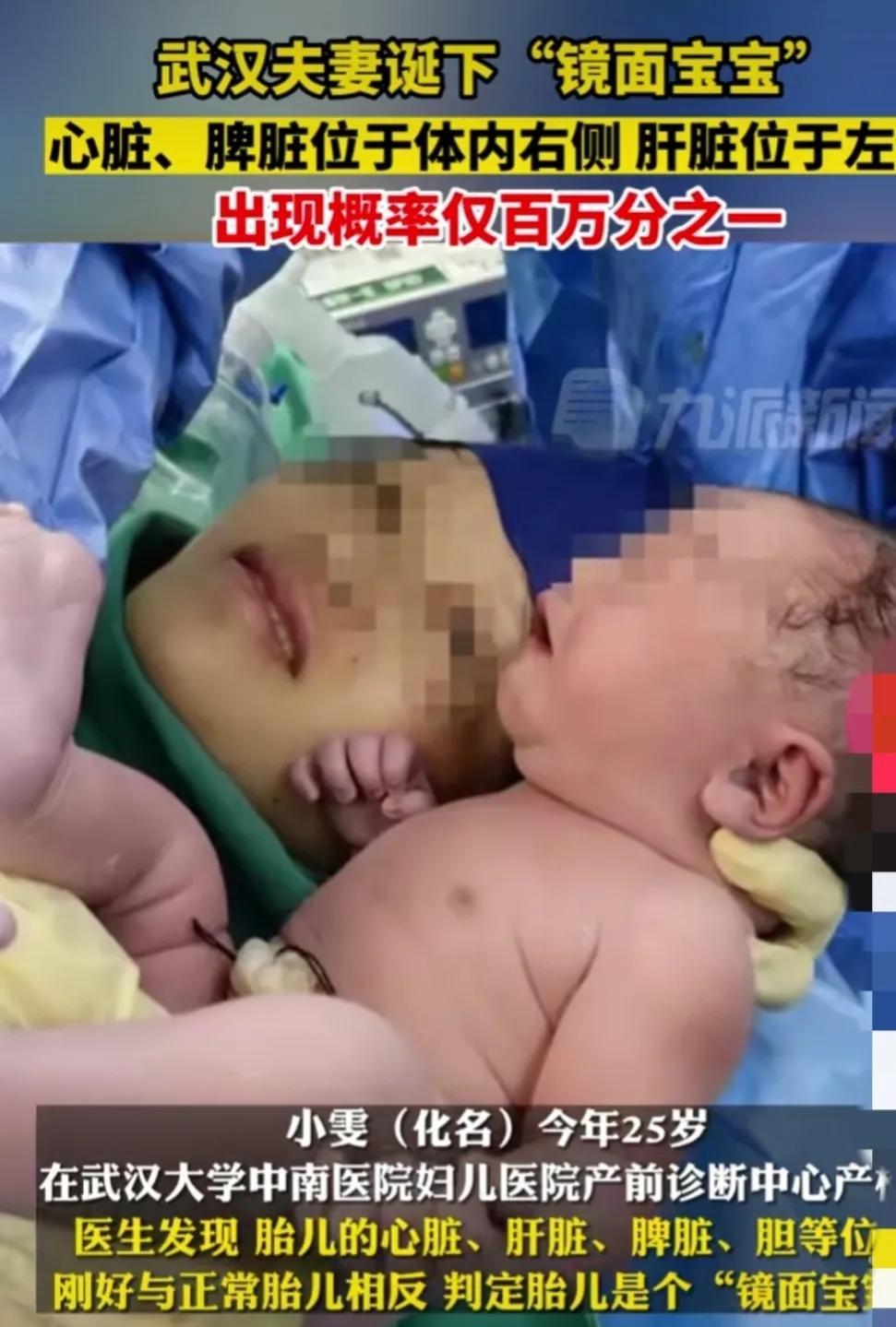 原创            武汉夫妻顺利诞下一个镜面宝宝-一对武汉夫妻的生死恋电影